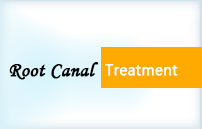 Paul Dental Clinic root canal treatment