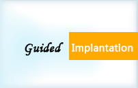 Paul Dental Clinic guided implantation