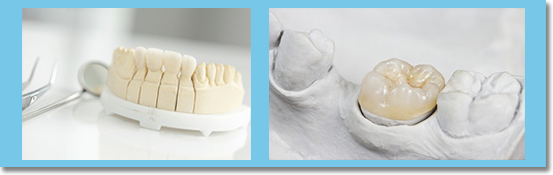 the crown made at Paul Dental is durable and looks natural