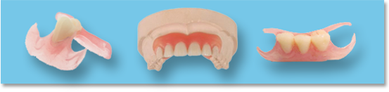  Elastic Denture (Invisible Denture)