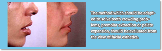 Soft tissue adaptations to the position of the teeth help determine the orthodontic plan and whether the orthodontic result will be stable.