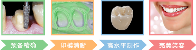 医生对牙体精确的预备和清晰的牙齿模型和技师高质量的制作共同成就保罗齿科高度精密效果