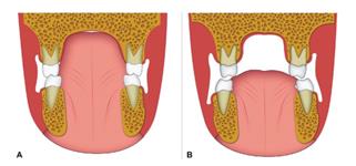 tongue position