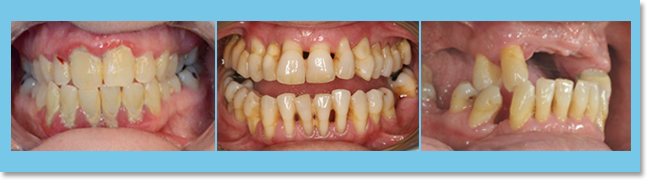 there is a close correlation between periodontal health and major body diseases, such as stroke and circulatory illnesses